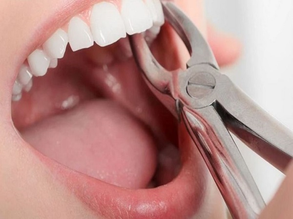 Mơ thấy nhổ các loại răng đặc biệt/p